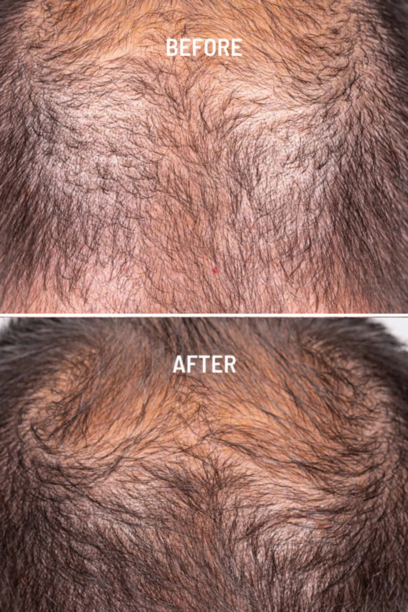 Hair Growth & Density tratamiento capilar